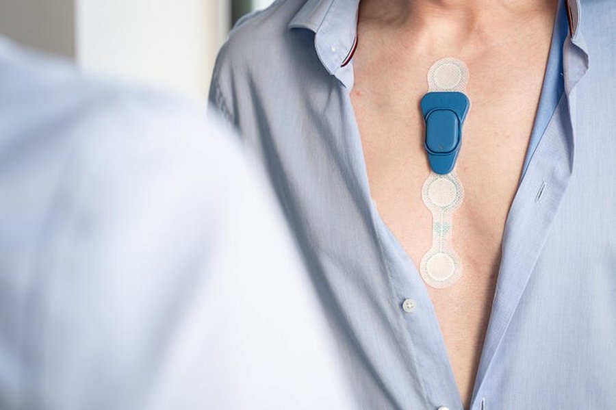 Électrocardiogramme ECG au cabinet de cardiologie IMPACT Cardiovasculaire Paris 11